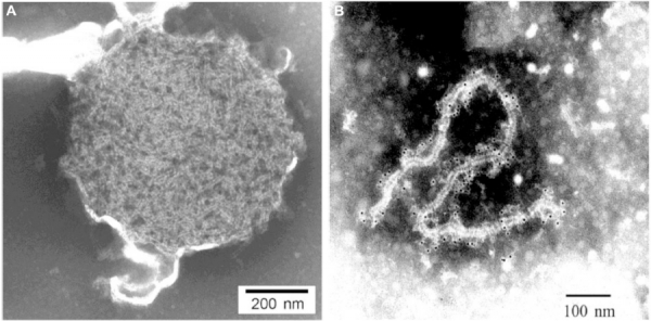 니파바이러스 입자 구조 출처: Hendra and Nipah viruses: pathogenesis, animal modes and recent breakthroughs in vaccination