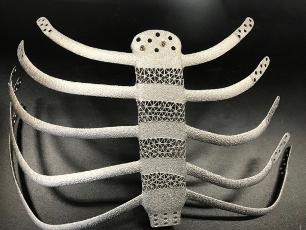 3D프린팅으로 제작된 순수 티타늄 소재 인공 흉곽 사진. 출처: 한국생산기술연구원