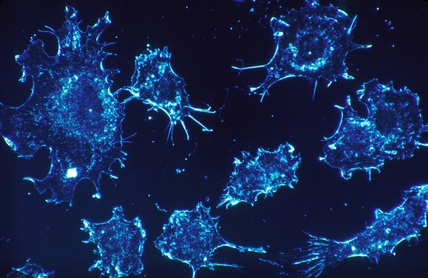 암세포는 조절하기 힘들만큼 빨리 증식한다. 출처: pixabay