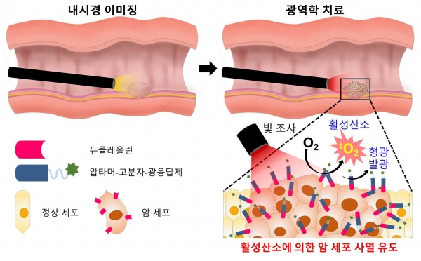 개발된 암 표적 광역학 소재를 이용한 내시경‧복강경의 진단‧치료 개략도. 출처: 한국연구재단