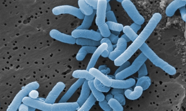 젖산균 중 하나인 Lactobacillus_paracasei. 출처: Wikimedia Commons