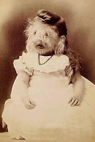 다모증에 걸린 소녀의 사진. 출처: Wikimedia Commons