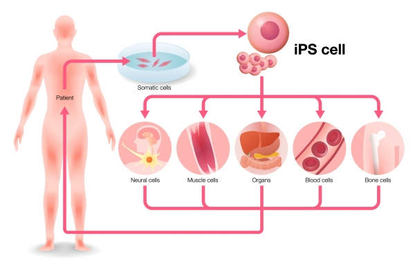 유도만능줄기세포는 다른 모든 유형의 세포로 발달하도록 만들 수 있는 미성숙한 세포이다. 출처: AdobeStock