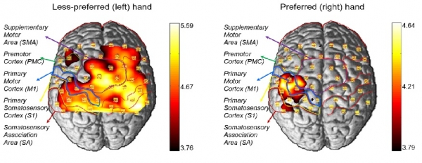 수동 촉각 자극에 따른 왼손과 오른손의 대뇌대사활성의 비대칭성을 보여주는 뇌 신호 활성화. 출처: DGIST