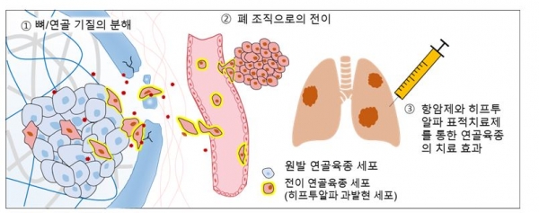연골육종암 환자들의 원발암 세포는 주변의 조직인 뼈와 연골의 기질을 분해하여 혈관을 타고 이동한다. 특히 히프투알파를 발현하고 있는 원발암 세포에서 내보내는 기질 분해 효소는 뼈와 연골 분해에 특이적이어서 원발 세포의 침윤이 더 쉽게 이뤄진다. 출처: 서울대학교
