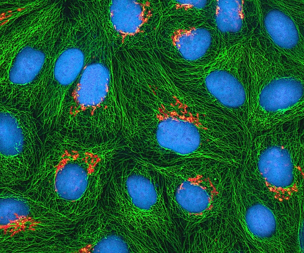염색한 헬라 세포. 출처: NIH