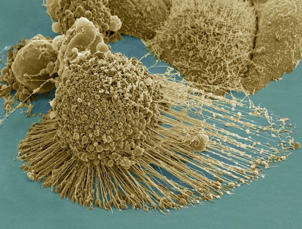 세포자살 중인 헬라 세포. 출처: NIH