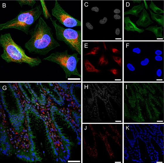 (B) BS-C-1 세포 내부 4종 단백질의 이미지. (C-F) 회색: DAPI, 녹색: 알파 튜블린, 적색: 비멘틴, 청색: 라민 B1. (G) 병리학 샘플의 4종 단백질 이미지. (H-K) 회색: DAPI, 녹색: 튜블린, 빨간색: 비멘틴, 파란색: 히스톤. 스케일바, 50μm. 출처: KAIST