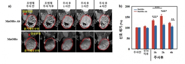 생체 내 인간 줄기세포 이식을 모니터링하기 위한 MnOHo-Ab의 이미징 시간 최적화. a) MnOHo-Ab 및 MnOHo의 정맥 주사 후 다양한 시간 (주사 전 : 주사 전, 즉시 : 주사 직후 및 주사 후 1, 2 및 4 시간)에서의 생체 내 T1 가중 MR 이미지; 빨간색 점선 내의 영역은 hiPSCs 유발 기형 종 영역. b) a)에서 MRI 이미지의 빨간색 점선 영역의 상대적 T1 신호 강도 (%) (신호 강도 (%) = ΔR / RNT, 여기서 ΔR = R-RNT); 빨간색 막대와 파란색 막대는 각각 MnOHo-Ab 및 MnOHO를 나타냄. 출처: 한국생명공학연구원