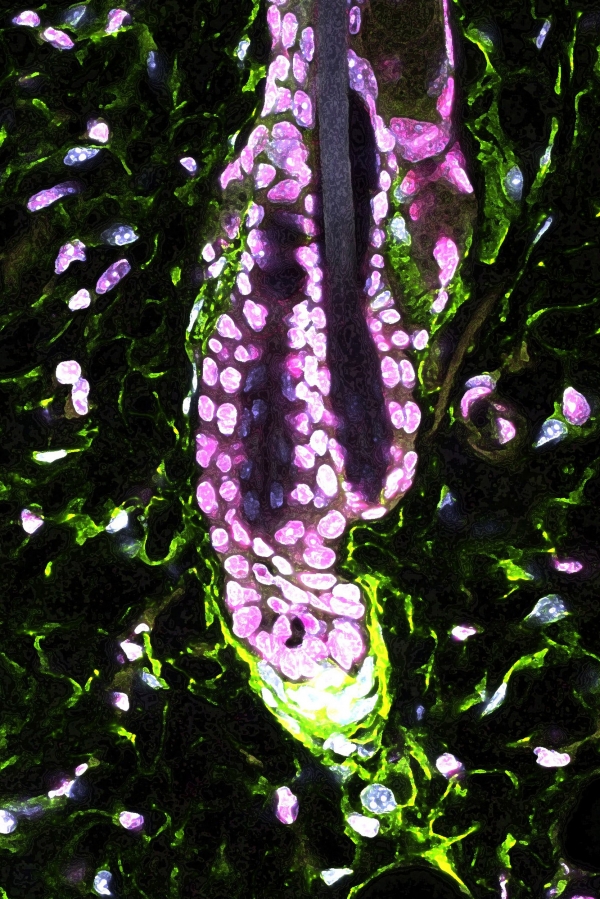 쥐의 모낭 아래에, 녹색으로 보이는 모유두 세포(dermal papilla)는 모낭 줄기세포를 활성화하는 Gas6 분자를 생성한다. 출처:  Hsu Laboratory, Harvard University