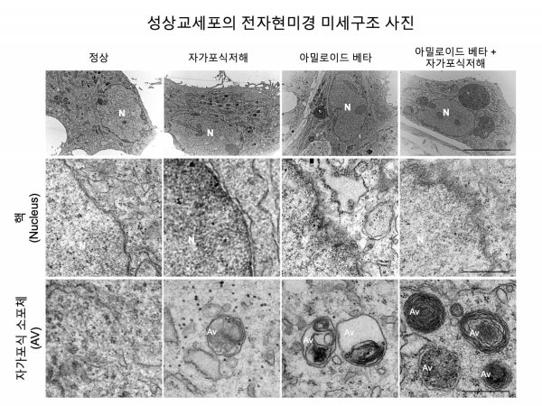 별세포내에서 자가포식 작용이 억제될 경우에 의 자가포식 소포가 쌓여져 아밀로이드 베타 (Aβ)의 제거가 억제됨. 별세포의 특이적인 자가포식 작용의 억제는 아밀로이드 베타 (Aβ)를 제거하기 위한 자가포식 소포(autophagy vesicle)를 통한 아밀로이드 베타 (Aβ)의 제거가 이루어지지 않아서 치매 병리를 나쁘게 변화 시킬 수 있음 보여주는 증거임. 출처: KIST